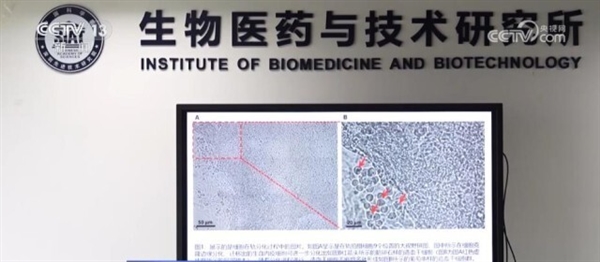 重大突破！我国首次实现人类干细胞太空造血
