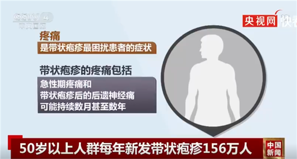 国产首款带状疱疹疫苗正式上市：40岁就能打
